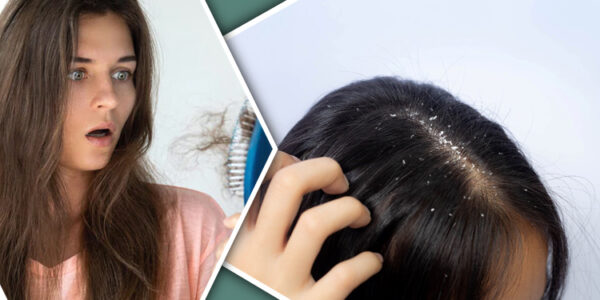 reduces hair fall and eliminates dandruff